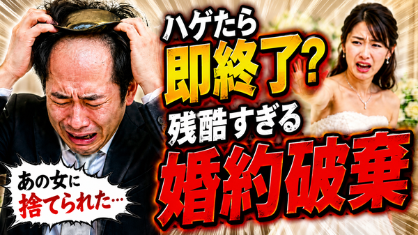 カツラなのがバレて婚約破棄に？～AGA治療